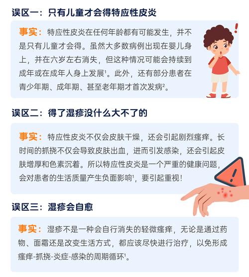 特应性皮炎:警惕单一病变多重威胁
